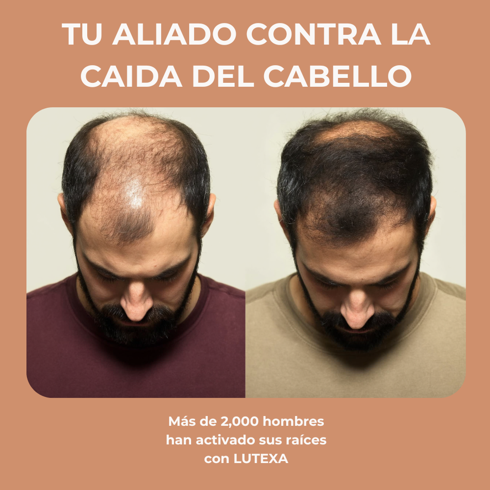 Champú Activador de Raíces