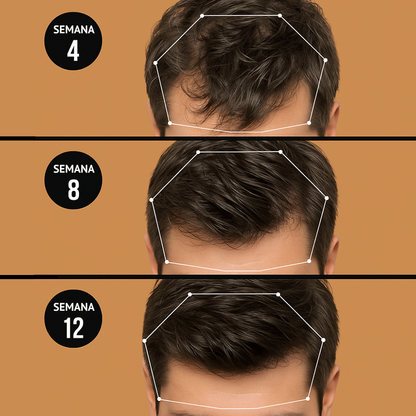 Champú Activador de Raíces